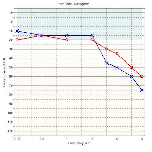 Industrial Hearing Screening